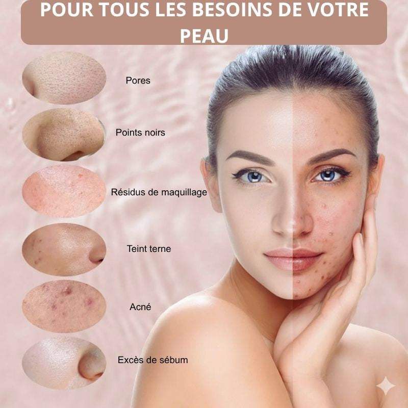 Brosse Nettoyante Visage Sonique